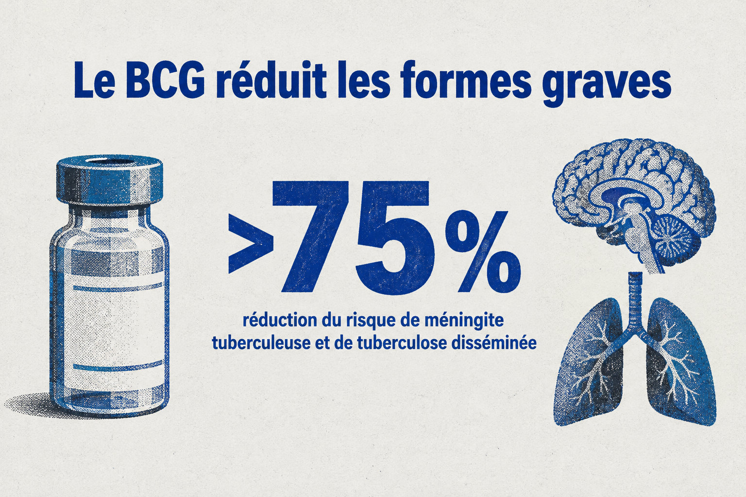 Chez les jeunes enfants vaccinés, le BCG réduit de plus de 75 % le risque de méningite tuberculeuse et de tuberculose disséminée.